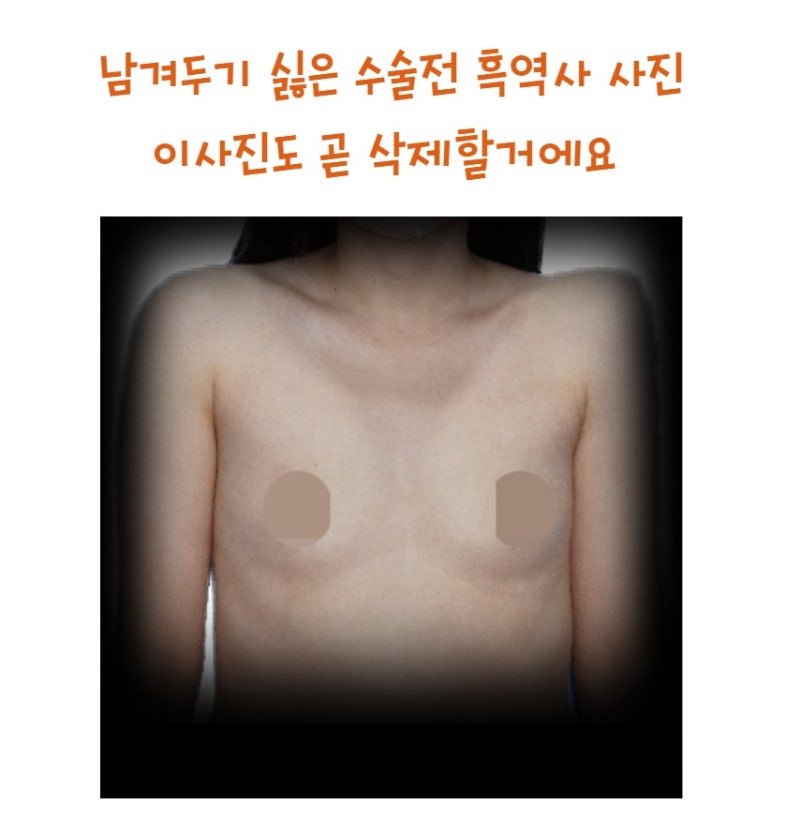 Motiva 340cc: One Month Review 사진 2