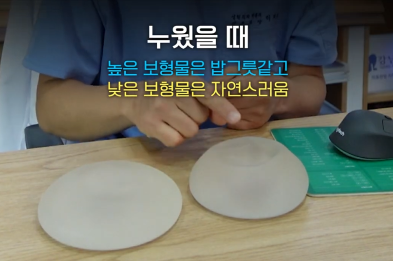 Two Crucial Factors When Deciding on Breast Augmentation with Implants? 사진 8