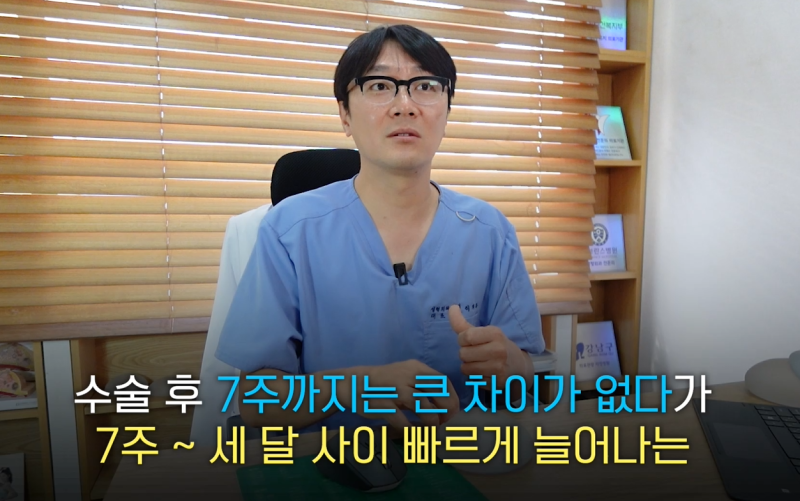 Breast Augmentation Surgery - What to Consider Before Deciding on Implant Size?? 사진 15