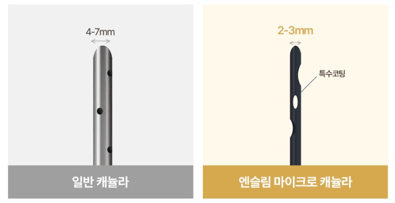허벅지 지방흡입 실제 사례, 1600~2000cc 변화 사진 8