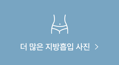 자연스러운 가슴 볼륨을 원한다면? (+실제전후) 사진 11