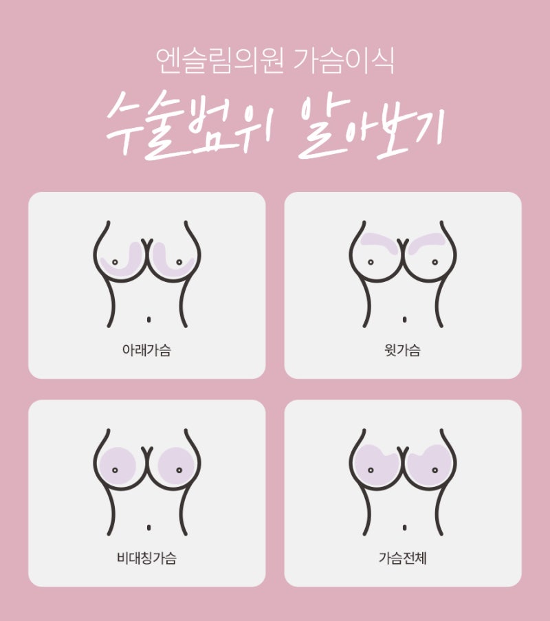 자연스러운 가슴 볼륨을 원한다면? (+실제전후) 사진 6