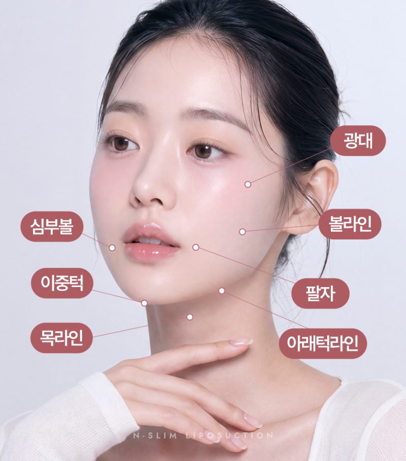 이중턱 지방흡입 50cc, 수술 전부터 3개월차까지 사진 7