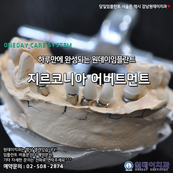 [원데이치과/원데이임플란트] 지르코니아 어버트먼트란?[심미성까지 생각한 임플란트, 화이트 어버트먼트]