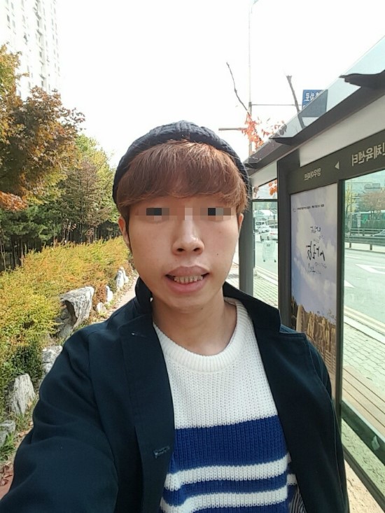 [원데이치과] 윤회의 교정일기 #3