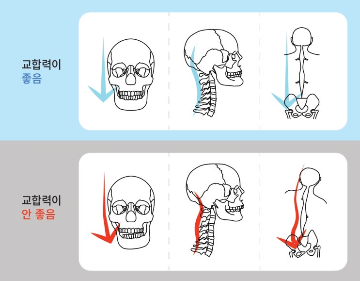[원데이치과 치아교정] 턱관절교합교정, 치아교정 - 심미성만 중요하게 생각하지마세요