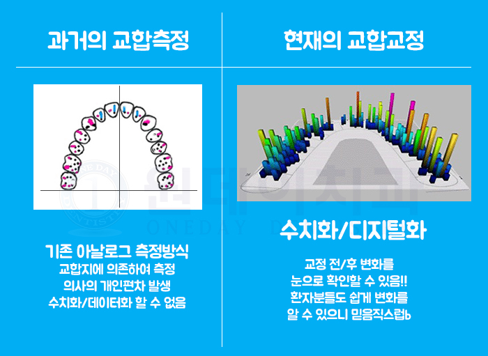 [원데이치과 교합교정] 정확하게 수치화 해서 보자!