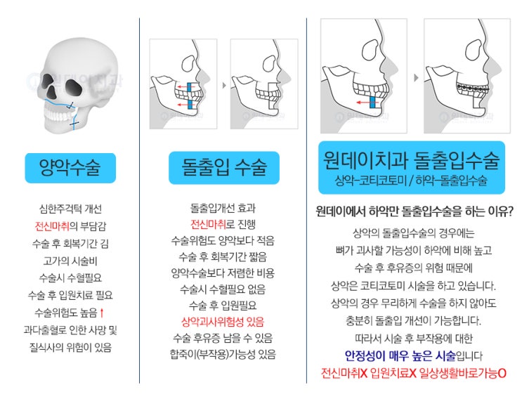 #6_돌출입수술[ASO]의 모든것