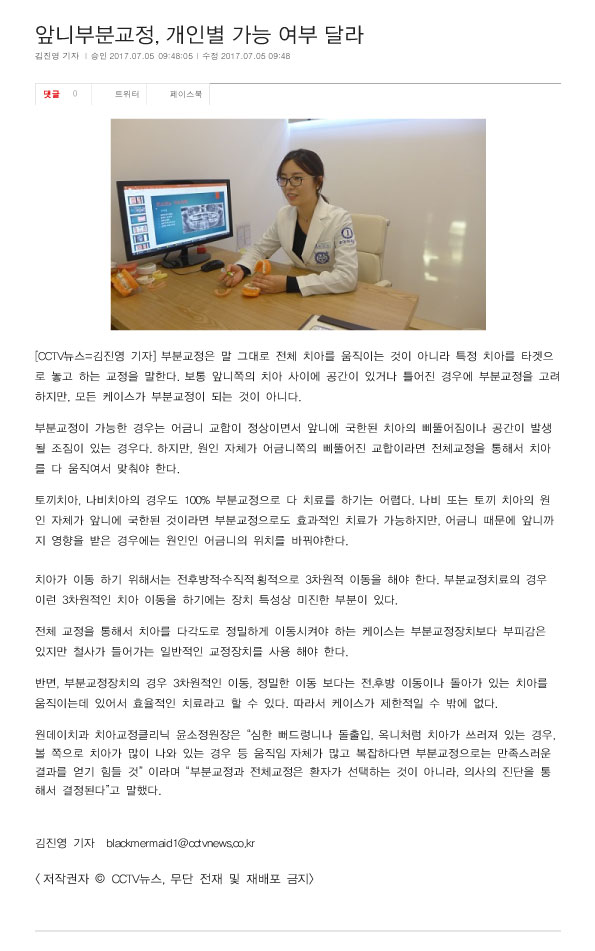 앞니부분교정, 개인별 가능 여부 달라