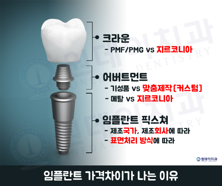 #14_천차만별인 임플란트 가격 - 임플란트 가격차이가 나는 이유는?