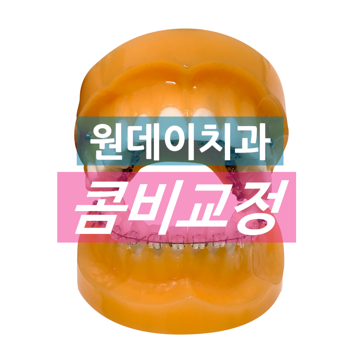 강남 원데이치과의 콤비교정! 티안나게 교정 하세요
