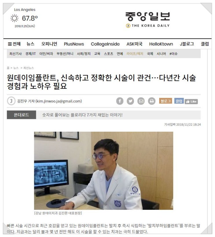 [원데이치과 보도기사] 원데이임플란트, 신속사고 정확한 시술이 관건···