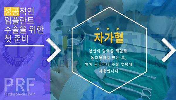 원데이치과의 원데이임플란트_ 당일 식립한 임플란트 회복을 빠르게 하는 비결은?
