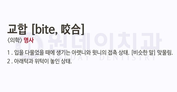 원데이치과에서 임플란트 시술 시 교합을 중요하게 생각하는 이유