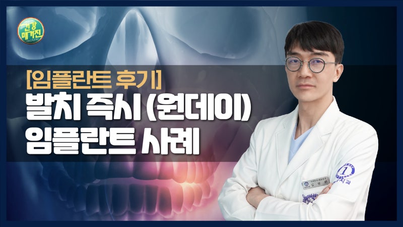 [건강매거진] #11. 발치즉시(원데이)임플란트 사례
