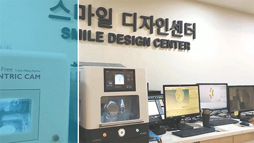 강남20대임플란트비용, 시간, 통증 걱정되죠? 사진 13
