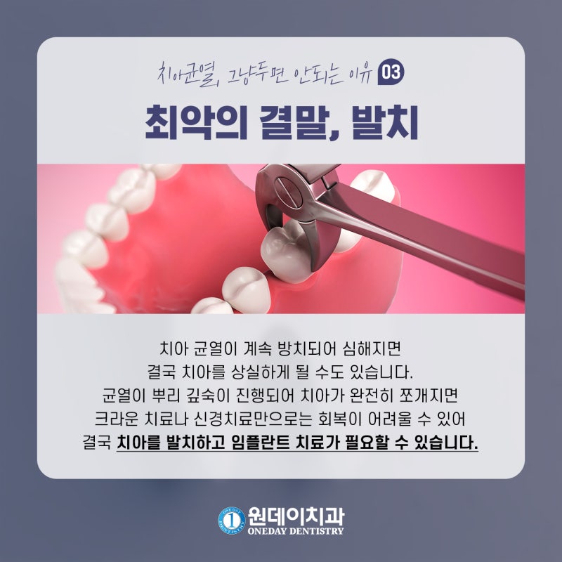 [원데이 치과]치아 균열, 그냥두면 안되는 이유! 사진 5