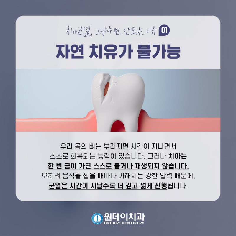 [원데이 치과]치아 균열, 그냥두면 안되는 이유! 사진 3
