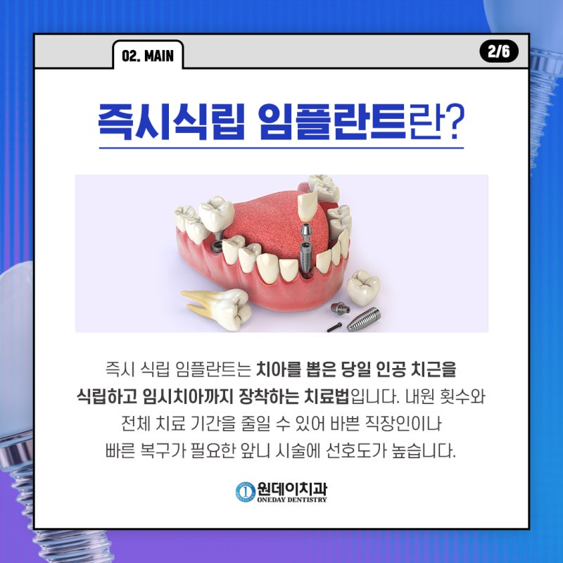 [원데이 치과]즉시식립 임플란트 누구나 가능할까?