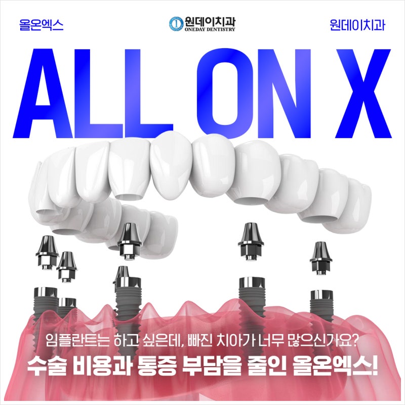 [원데이 치과]올온엑스! 누구에게 적합할까?