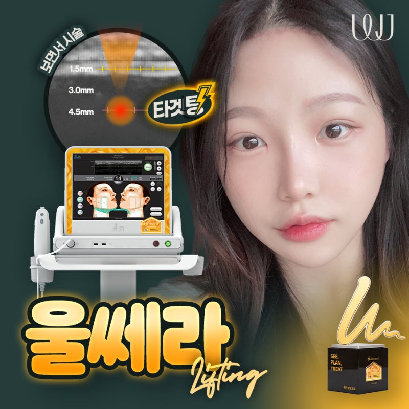 울쎄라 효과, 정밀한 타겟팅으로 맞춤 리프팅