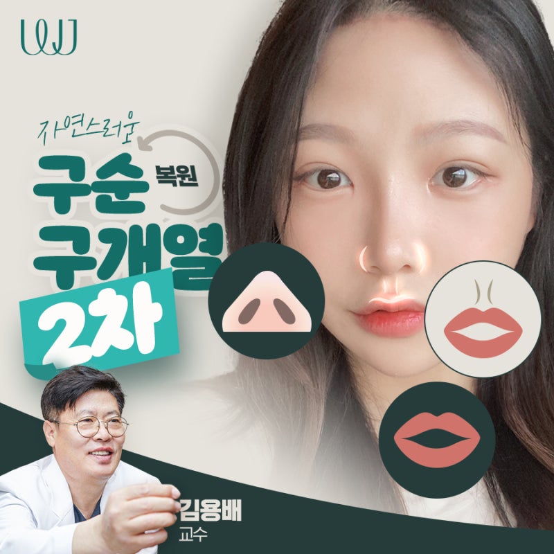 구순구개열 2차수술 자연스럽고 정교한 복원