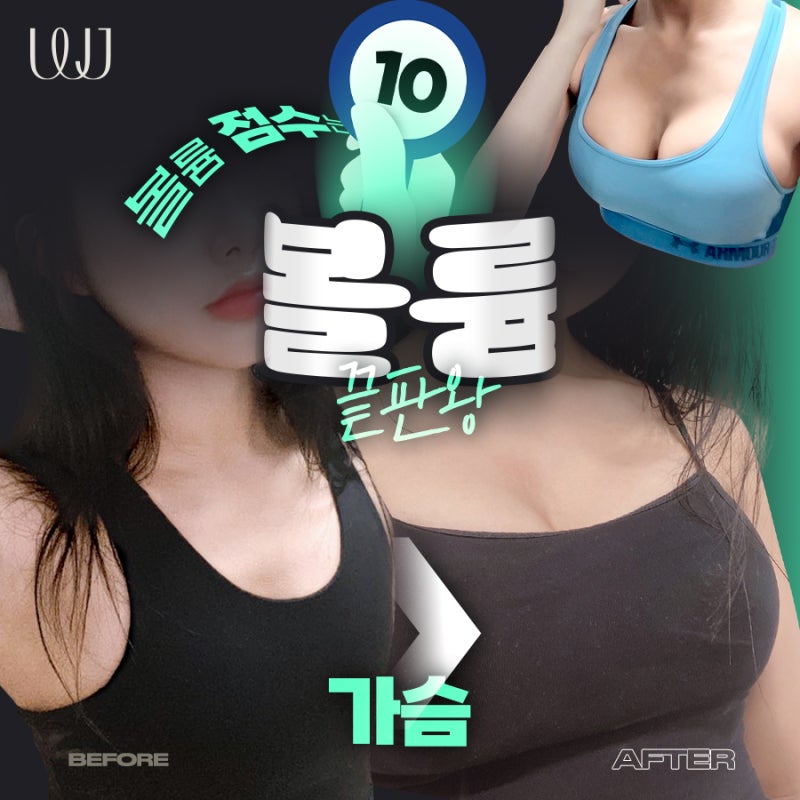 가슴성형 전후 달라진 라인과 자신감!
