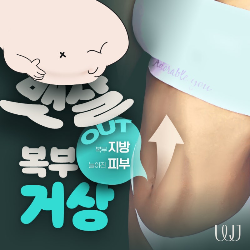 복부성형, 지방흡입과 거상을 동시에