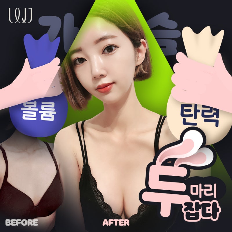 출산 후 가슴성형 전후와 회복과정