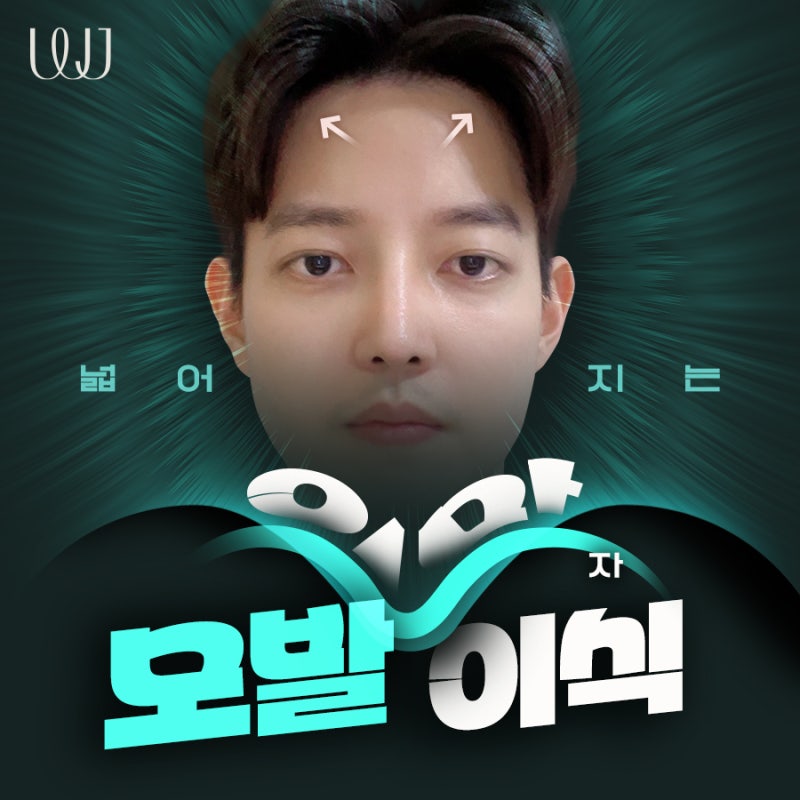 M자모발이식전후 풍성함에서 오는 자신감