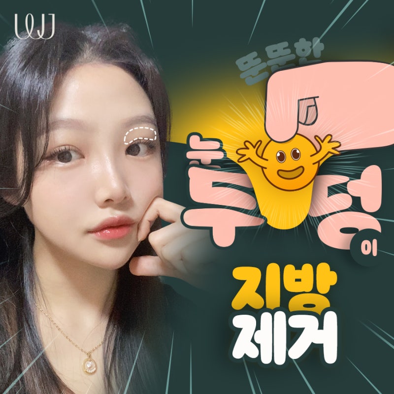 부어 보이는 눈두덩이 지방제거 효과는?