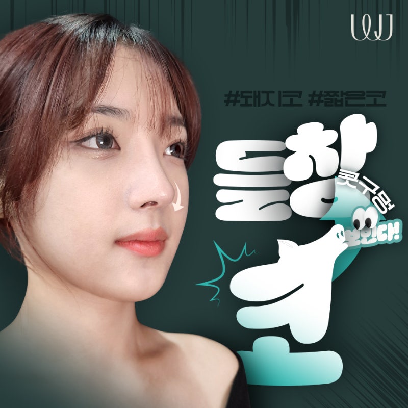돼지코 콤플렉스 들창코성형이란?