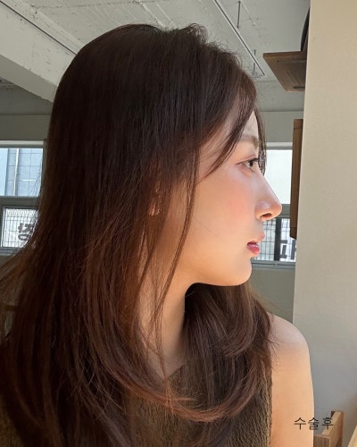 코성형 하나로 달라진 이미지 매부리코 직반코성형 전후 사진 7