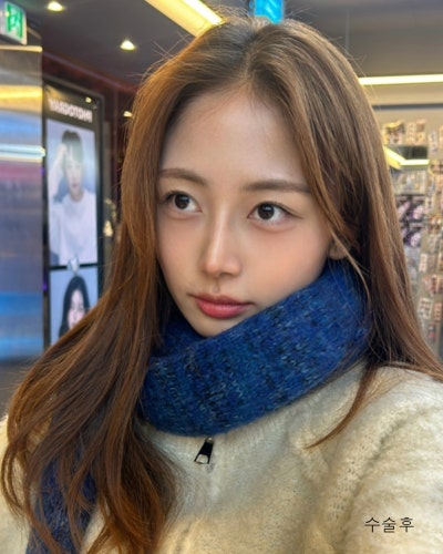 코성형 하나로 달라진 이미지 매부리코 직반코성형 전후 사진 3