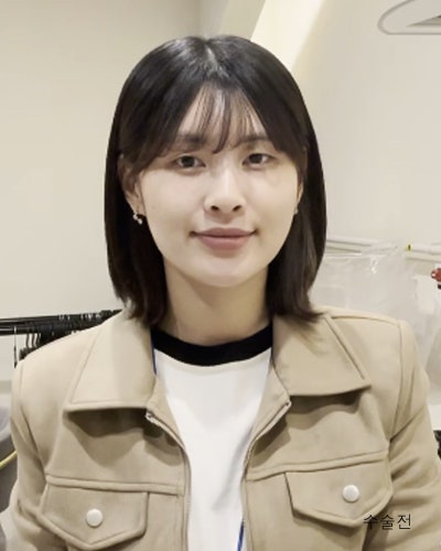 풀린눈재수술, 이마거상, 코성형 전후 사진 2