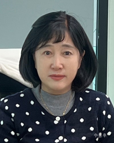 중년성형 안면거상,이마거상,눈매교정,하안검 전후 사진 11