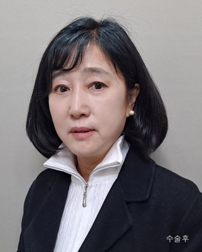 중년성형 안면거상,이마거상,눈매교정,하안검 전후 사진 9
