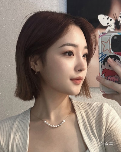 원진성형외과의원 낮은복코 자려한코성형 전후 사진 7