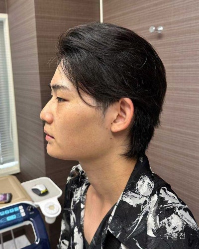 남자성형전후 눈매교정, 코성형, 윤곽3종 사진 6