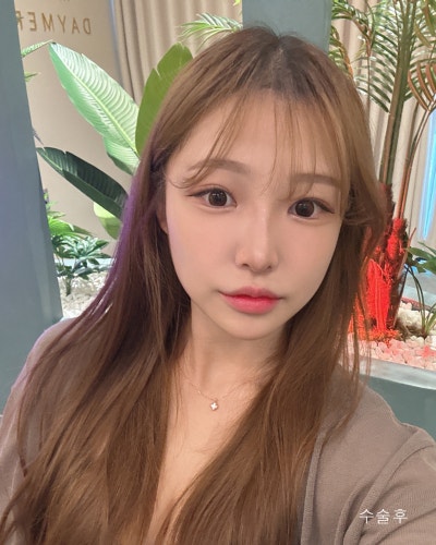 눈코성형,이마거상축소,얼굴지방흡입,실리프팅 전후 사진 3