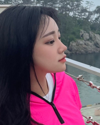 원진성형외과의원 눈코성형,엔젤아이,윤곽3종 전후 사진 9