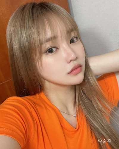 원진성형외과의원 눈코성형,엔젤아이,윤곽3종 전후 사진 7