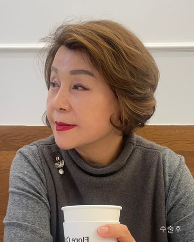 중년성형 이마축소거상, 안면거상전후와 흉터관리방법 사진 3