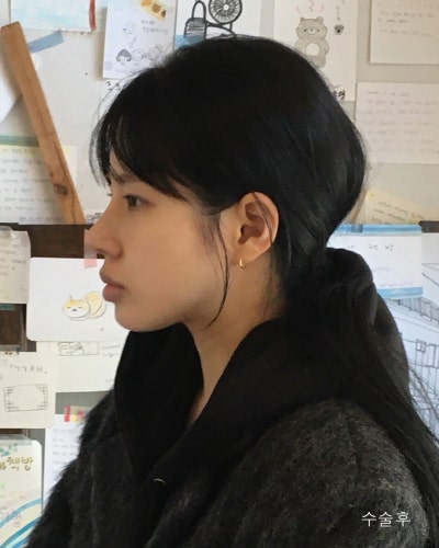 윤곽3종, 코성형 전후로 확인하는 효과 사진 9
