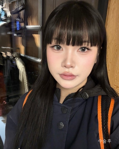 기능,미용개선 주걱턱 양악윤곽전후와 회복기간 사진 12