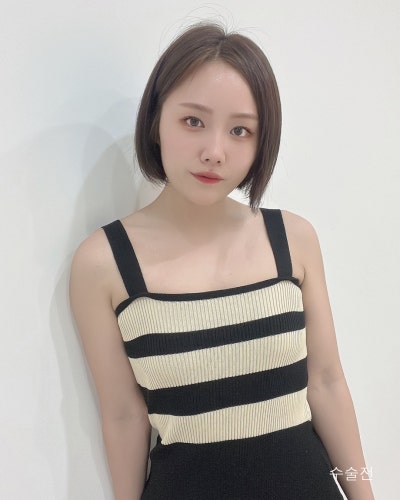 다이어트 후 사라진 가슴 멘토부스트 가슴성형 전후 사진 6