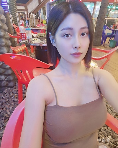 벌어진 새가슴체형 가슴골 만들기 가슴성형 전후 사진 5
