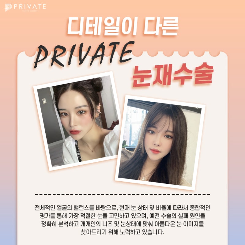 눈재수술유명한곳 프라이빗성형외과