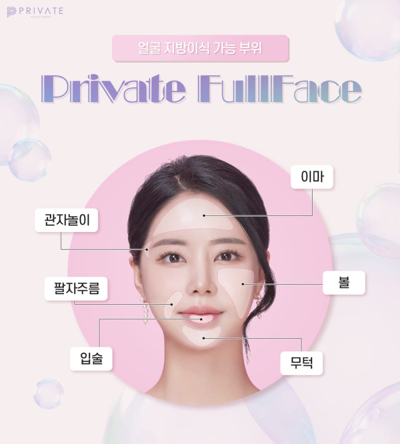 프라이빗 풀페이스지방이식으로 탄력있는 얼굴 볼륨감 UP 사진 4
