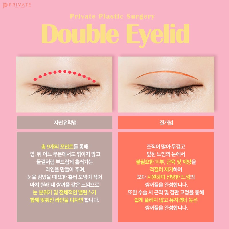 눈재수술유명한곳 프라이빗성형외과!